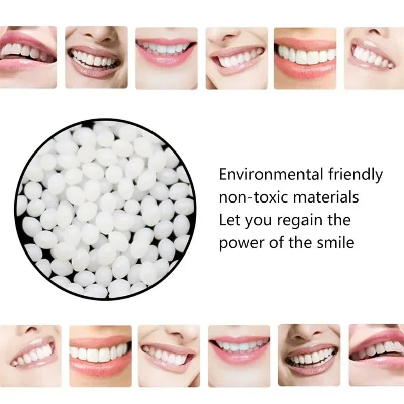 InstantSmile Temporary Tooth Repair Kit 100g