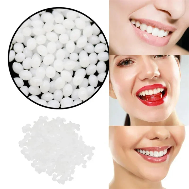 InstantSmile Temporary Tooth Repair Kit 100g